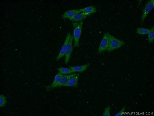 [16341-1-AP-20UL] FARSB Polyclonal antibody