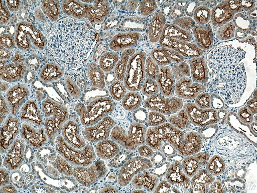 [16343-1-AP-150UL] SLC3A1 Polyclonal antibody