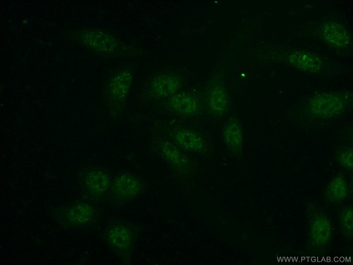 [16345-1-AP-150UL] PSF3 Polyclonal antibody