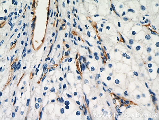 [16346-1-AP-150UL] AGER Polyclonal antibody