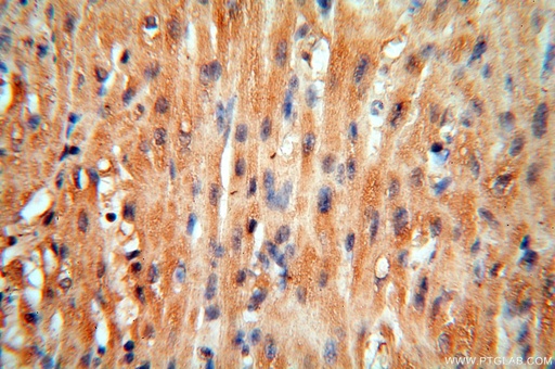 [16357-1-AP-20UL] cyclin I Polyclonal antibody