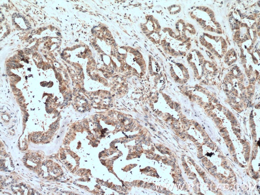 [16364-1-AP-150UL] VAV1 Polyclonal antibody