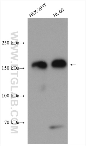 [16370-1-AP-150UL] WAPL; WAPAL Polyclonal antibody