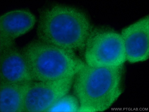 [16371-1-AP-20UL] GTPBP9 Polyclonal antibody