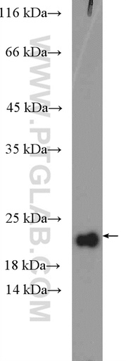 [16377-1-AP-20UL] RPP21 Polyclonal antibody