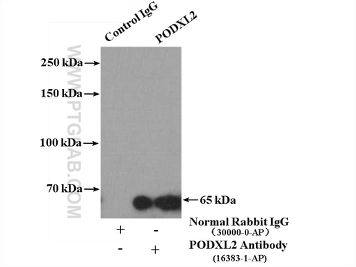 [16383-1-AP-150UL] PODXL2 Polyclonal antibody
