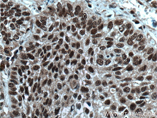 [16393-1-AP-20UL] BANP Polyclonal antibody