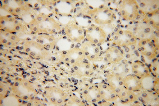 [16401-1-AP-20UL] PISD Polyclonal antibody