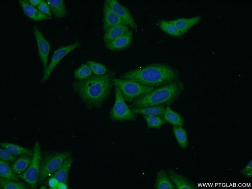 [16409-1-AP-20UL] Biglycan Polyclonal antibody