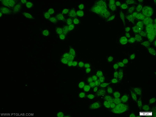 [16418-1-AP-150UL] NELFB Polyclonal antibody