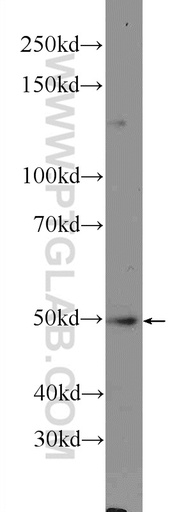 [16419-1-AP-150UL] NLE1 Polyclonal antibody