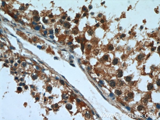 [16420-1-AP-20UL] FUCA1 Polyclonal antibody