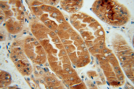[16424-1-AP-150UL] CHMP7 Polyclonal antibody