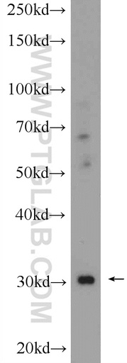 [16426-1-AP-20UL] CHST8 Polyclonal antibody