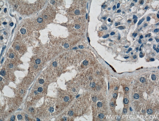 [16428-1-AP-20UL] MRPS5 Polyclonal antibody