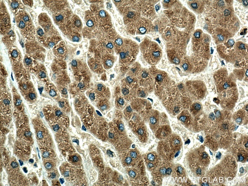 [16439-1-AP-150UL] ORM1 Polyclonal antibody