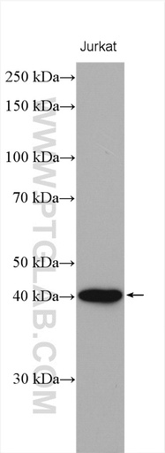 [16445-1-AP-20UL] PNMA2 Polyclonal antibody