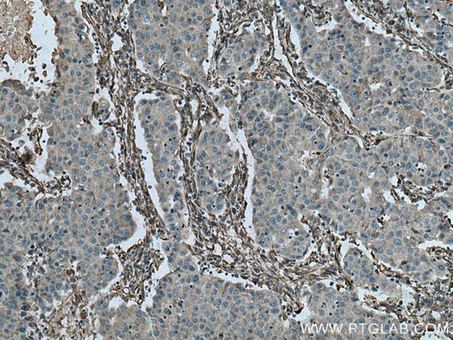 [16447-1-AP-150UL] Caveolin-1 Polyclonal antibody