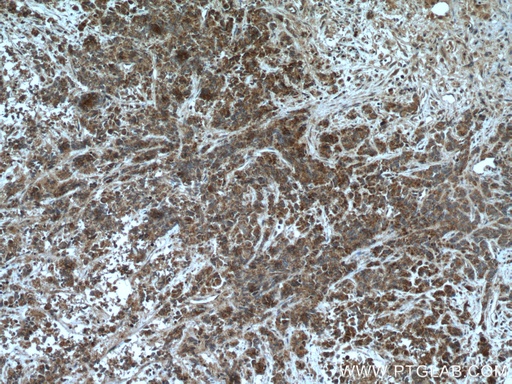 [16449-1-AP-150UL] AGXT2L2 Polyclonal antibody