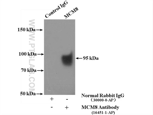 [16451-1-AP-150UL] MCM8 Polyclonal antibody