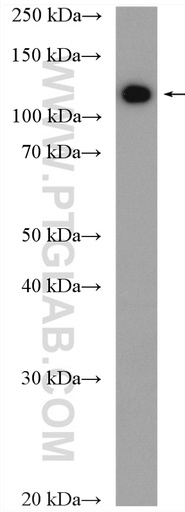 [16454-1-AP-150UL] AP3D1 Polyclonal antibody