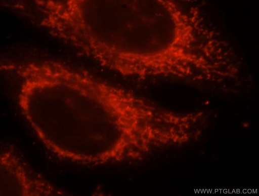 [16457-1-AP-20UL] MRPS35 Polyclonal antibody