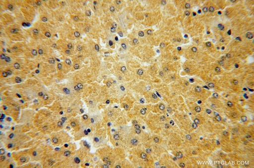 [16465-1-AP-20UL] HGD Polyclonal antibody