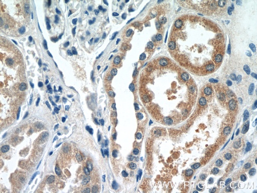 [16466-1-AP-150UL] DPEP2 Polyclonal antibody