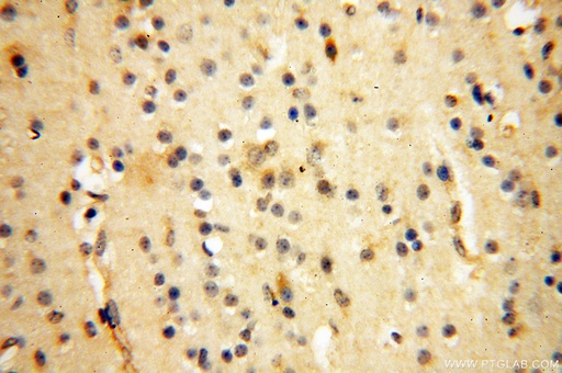 [16470-1-AP-20UL] PCSK5 Polyclonal antibody