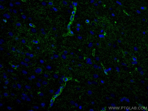 [16473-1-AP-150UL] Aquaporin 4 Polyclonal antibody