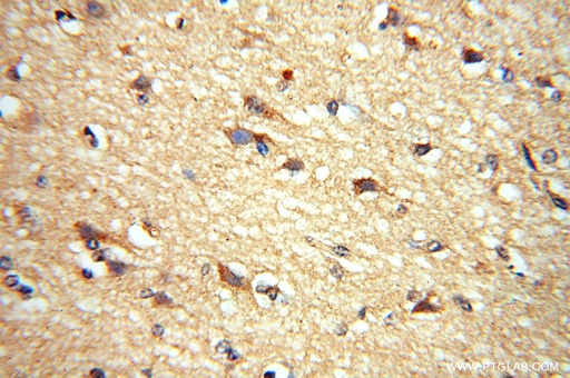 [16479-1-AP-150UL] ADO Polyclonal antibody