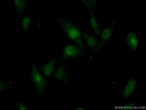 [16484-1-AP-20UL] RBM28 Polyclonal antibody
