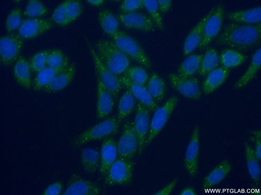 [16486-1-AP-150UL] EDC3 Polyclonal antibody
