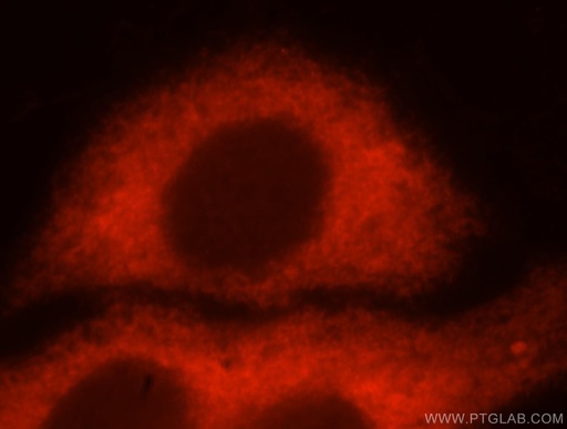 [16490-1-AP-20UL] RPS12 Polyclonal antibody