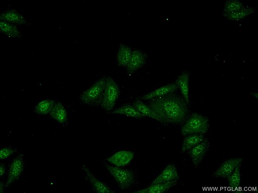 [16502-1-AP-20UL] SDCCAG10 Polyclonal antibody