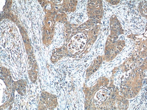 [16509-1-AP-150UL] ODAM Polyclonal antibody