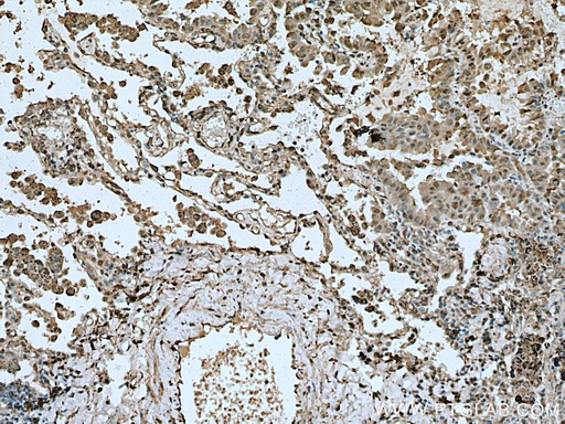 [16527-1-AP-150UL] METTL6 Polyclonal antibody