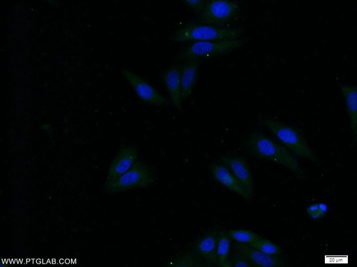 [16530-1-AP-20UL] APOC4 Polyclonal antibody