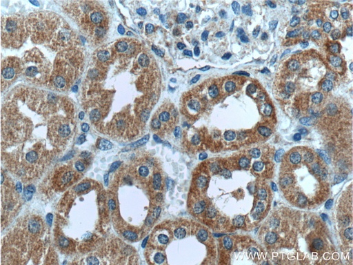 [16533-1-AP-150UL] MRPS9 Polyclonal antibody