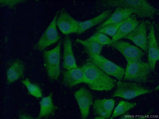 [16534-1-AP-20UL] CTHRC1 Polyclonal antibody
