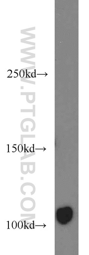 [16541-1-AP-150UL] AXIN1 Polyclonal antibody