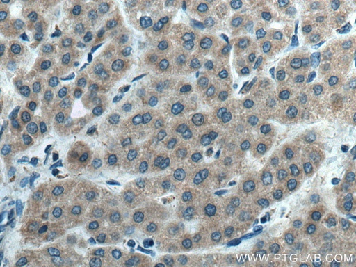 [16546-1-AP-20UL] CYP2C8/9/18/19 Polyclonal antibody