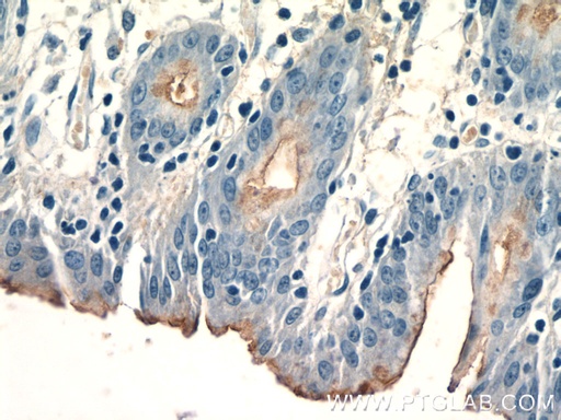 [16550-1-AP-150UL] CCKAR-specific Polyclonal antibody