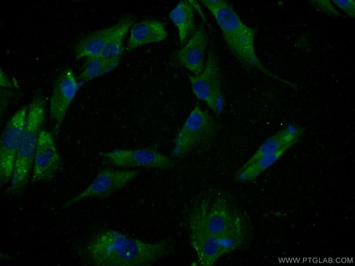 [15870-1-AP-20UL] SPANXE Polyclonal antibody
