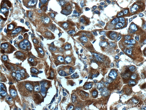 [15880-1-AP-150UL] TDO2 Polyclonal antibody