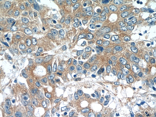 [15886-1-AP-150UL] MOBKL3 Polyclonal antibody