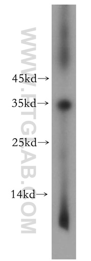 [15893-1-AP-150UL] TNNT1 Polyclonal antibody