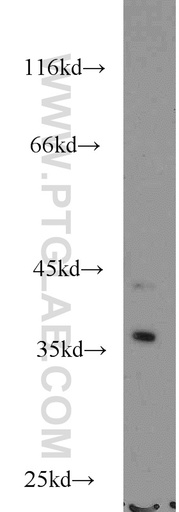 [15899-1-AP-150UL] NECAP2 Polyclonal antibody