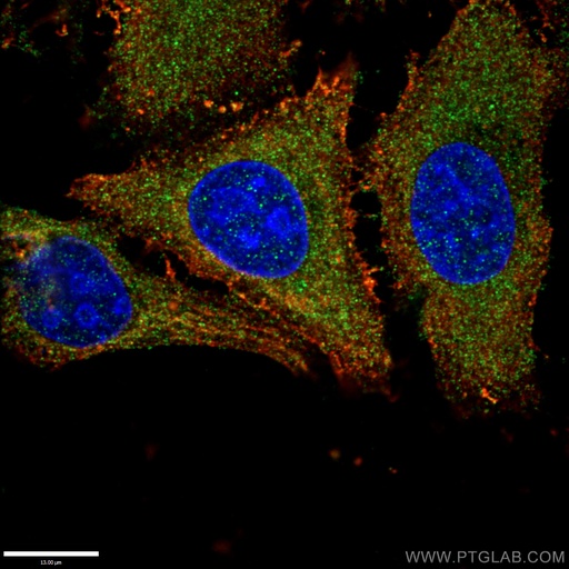 [15903-1-AP-20UL] RAB11A/B Polyclonal antibody