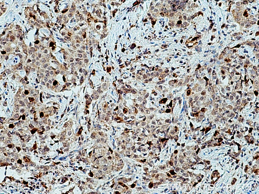 [15911-1-AP-20UL] KIF20A Polyclonal antibody